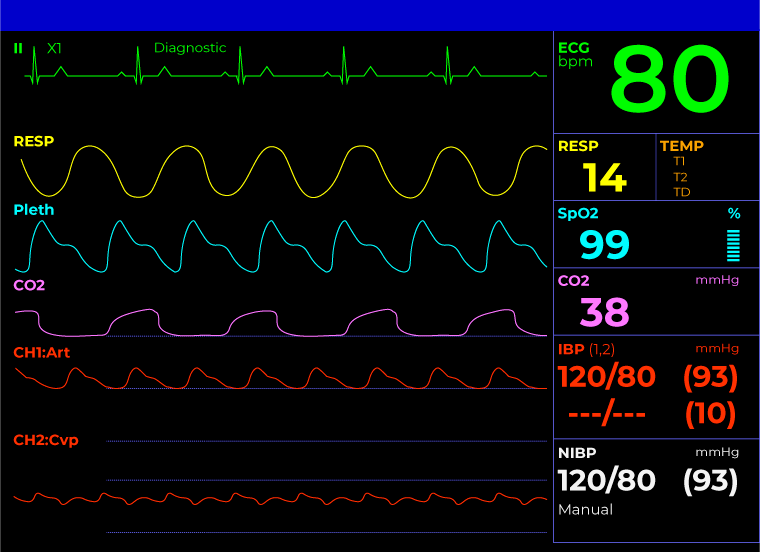patient monitor screen